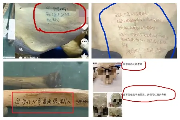 中国接连发生医学生侮辱“大体老师”事件 中国接连发生医学生侮辱“大体老师”事件